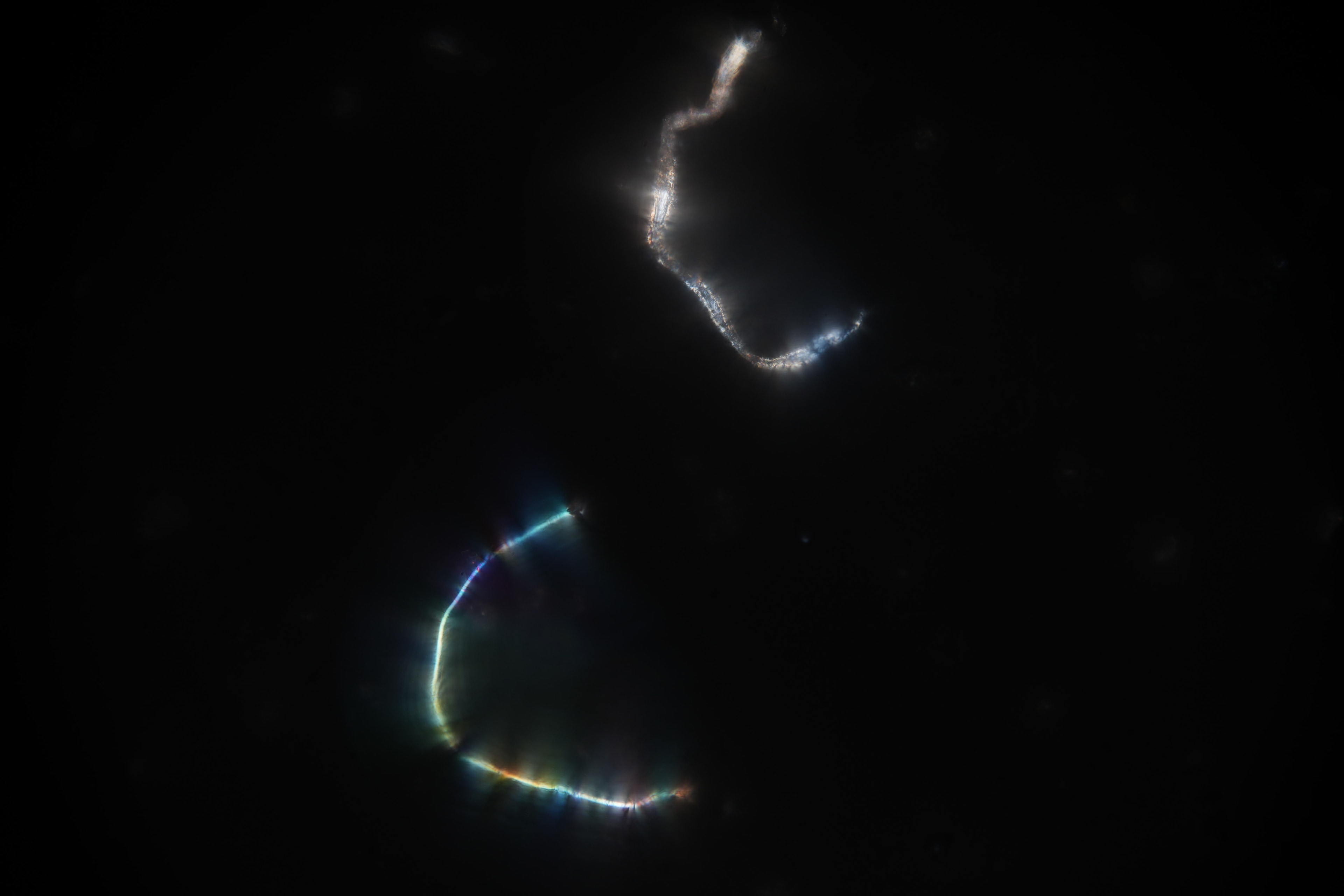 Two pieces of lint on a microscope slide catch and bend the light.